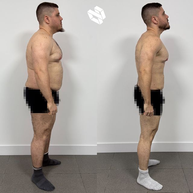 Transformación de Adriano