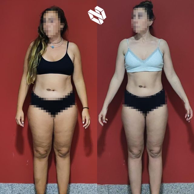 Transformación de Amaya