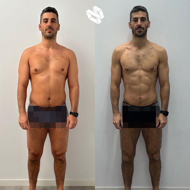 Transformación de Eder