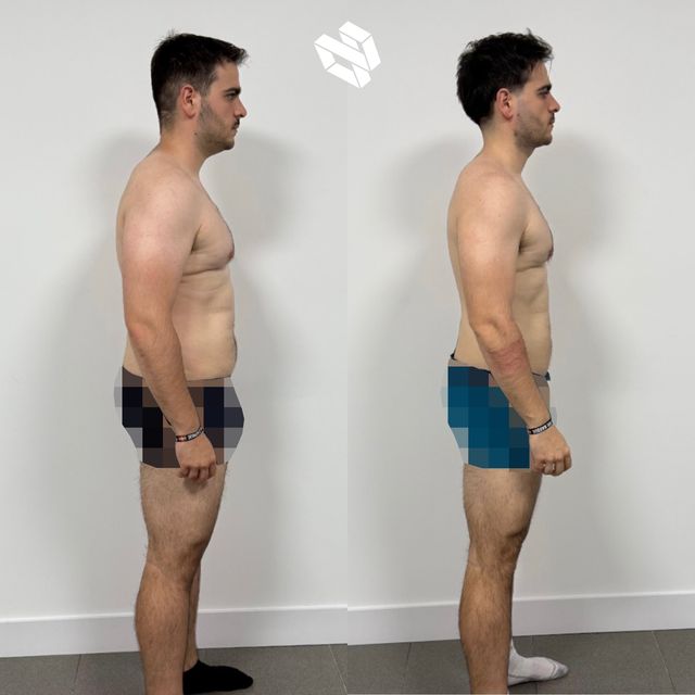 Transformación de Gaizka