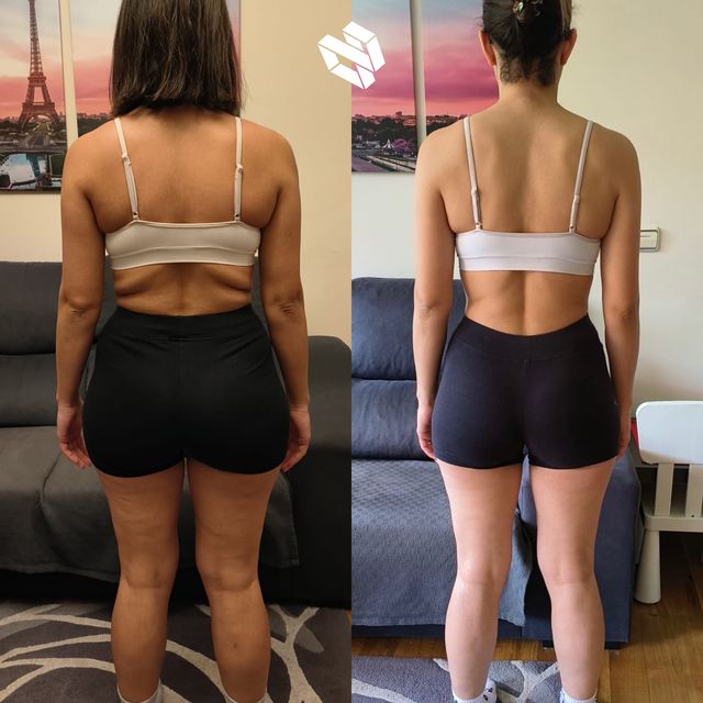 Transformación de Hanan