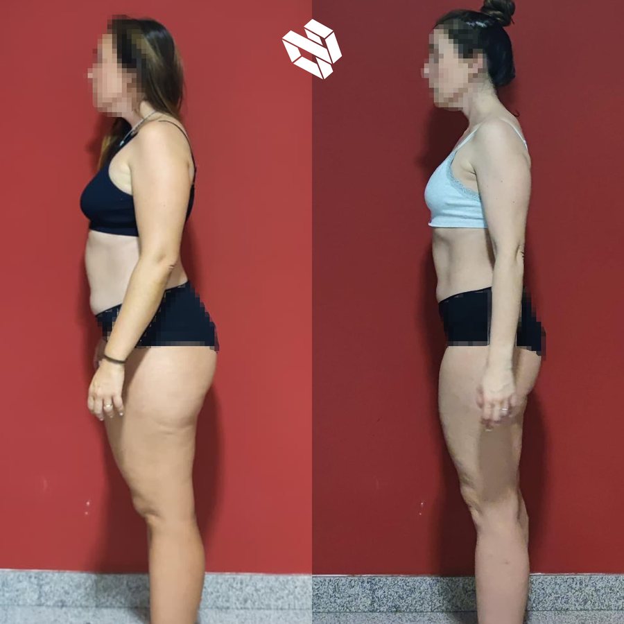 Transformación de Amaya — pérdida de grasa