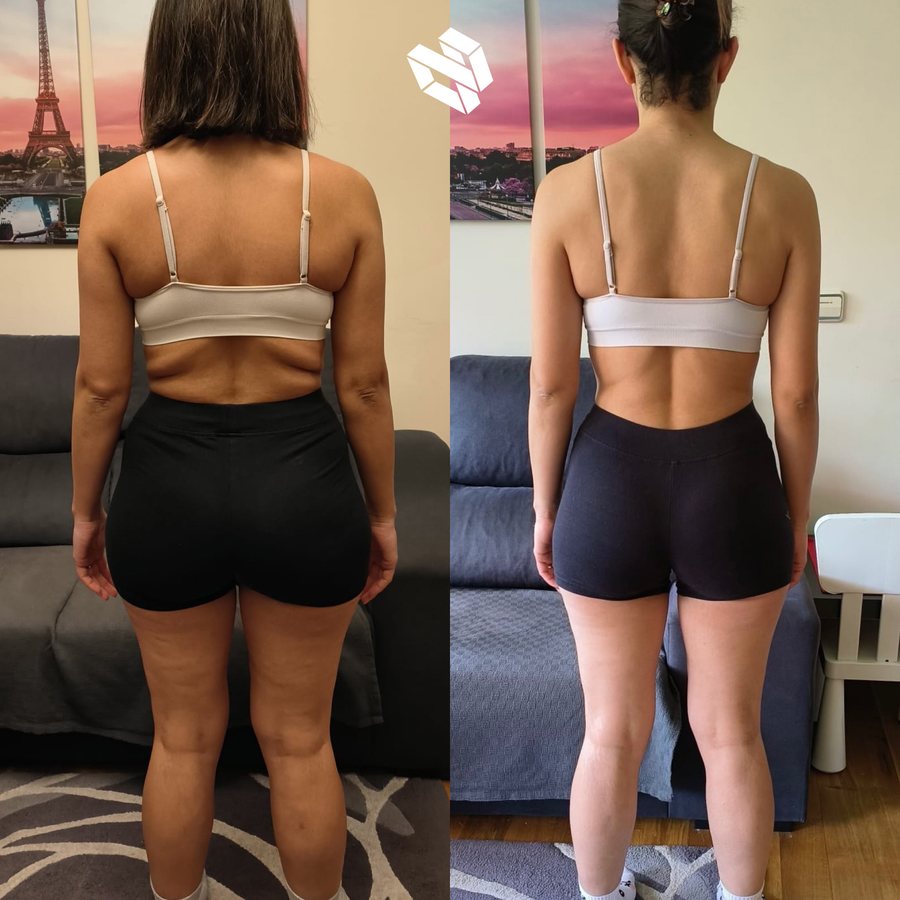 Transformación de Hanan — pérdida de grasa