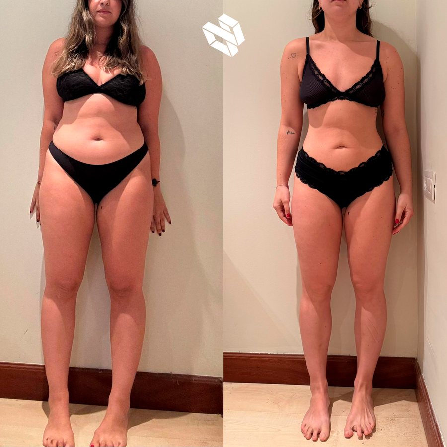 Transformación de Irune I. — pérdida de grasa
