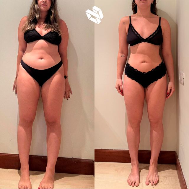Transformación de Irune I.