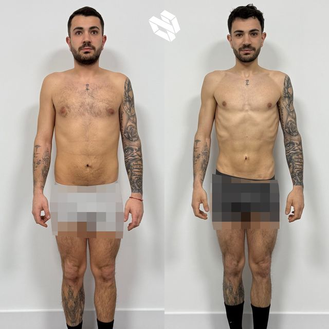 Transformación de Koldo